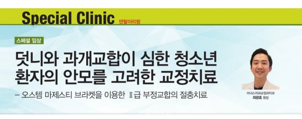 심한 덧니 과개교합 청소년 교정 증례